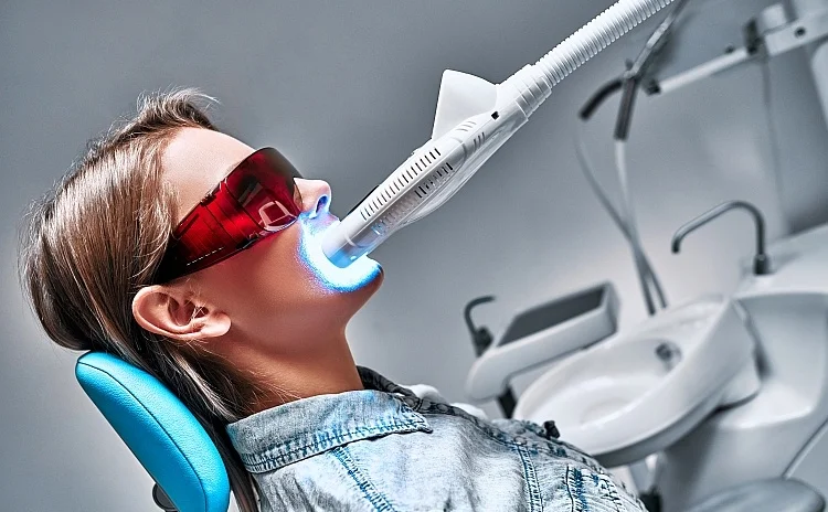 Blanchiment dentaire professionnel Blanchiment dentaire professionnel